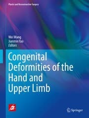 Cover von Congenital Deformities of the Hand and Upper Limb